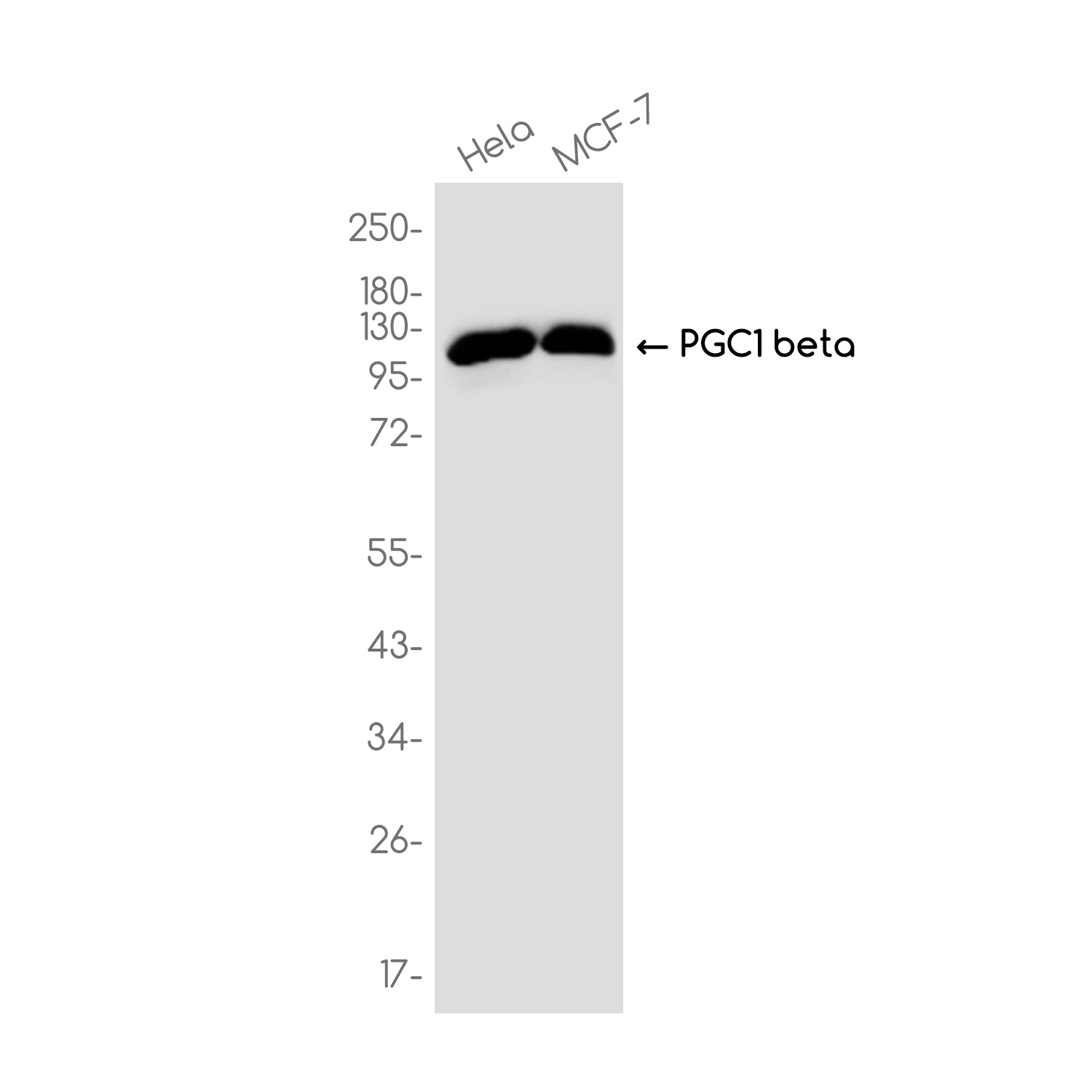 Anti-PGC1 beta Rabbit Monoclonal Antibody