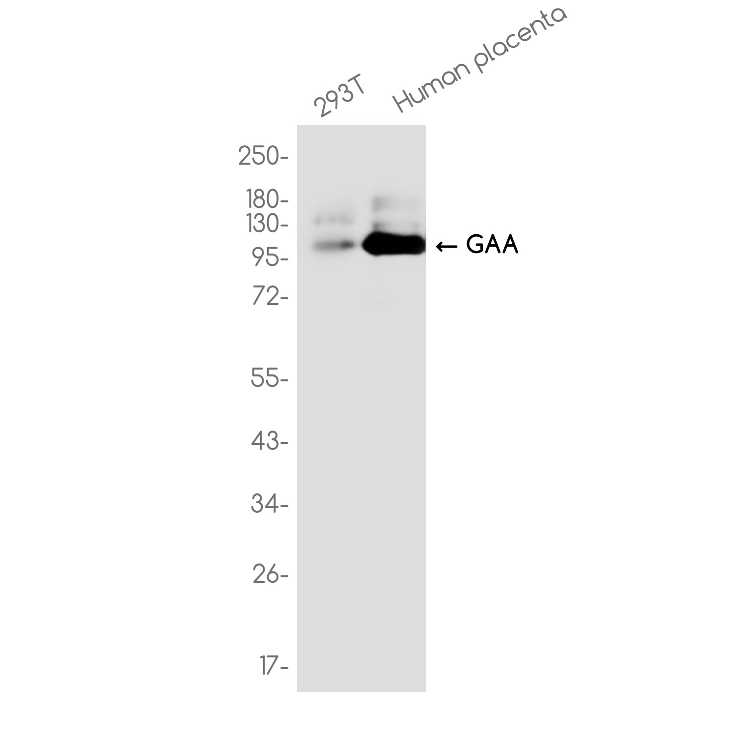 Anti-GAA Rabbit Monoclonal Antibody
