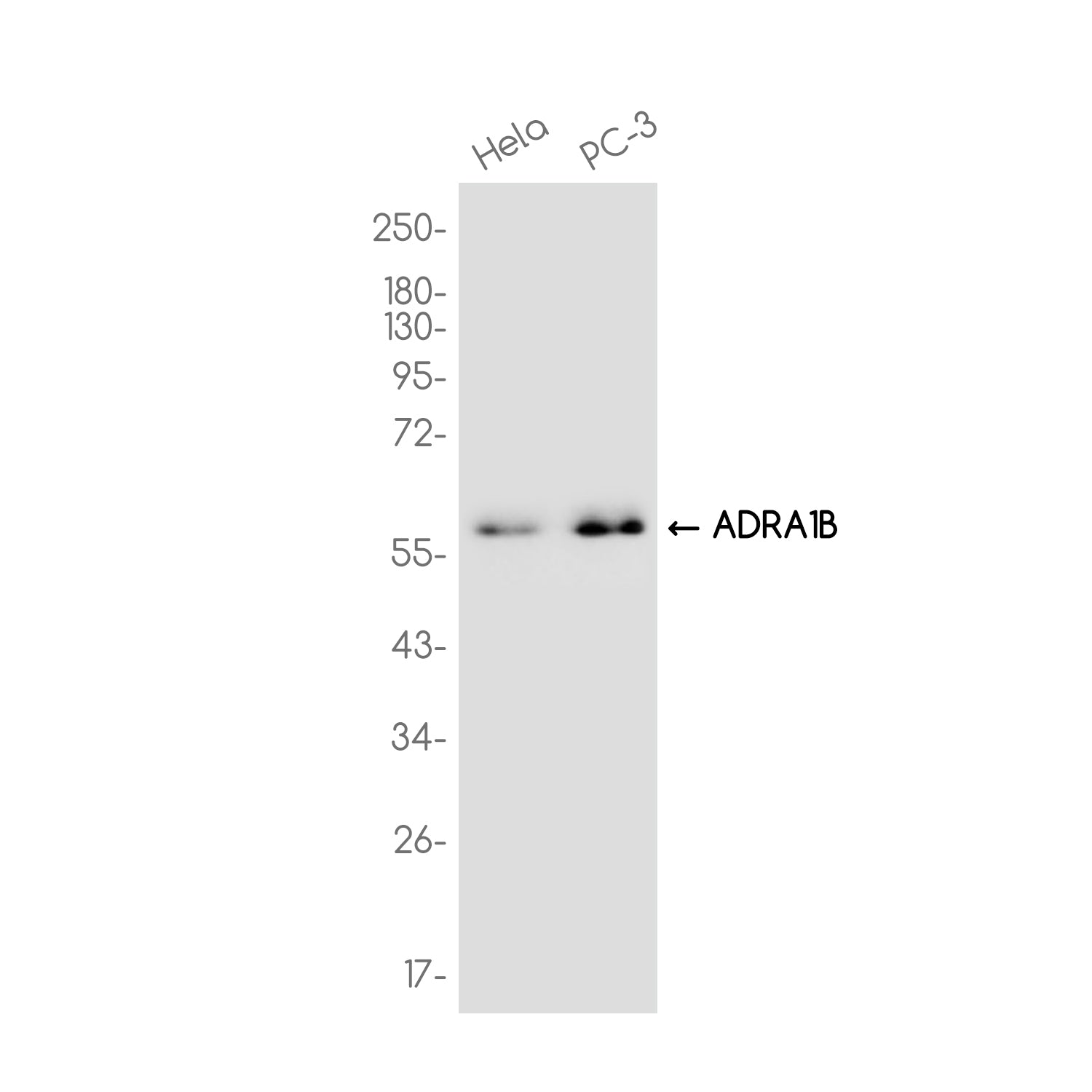 Anti-ADRA1B Rabbit Monoclonal Antibody