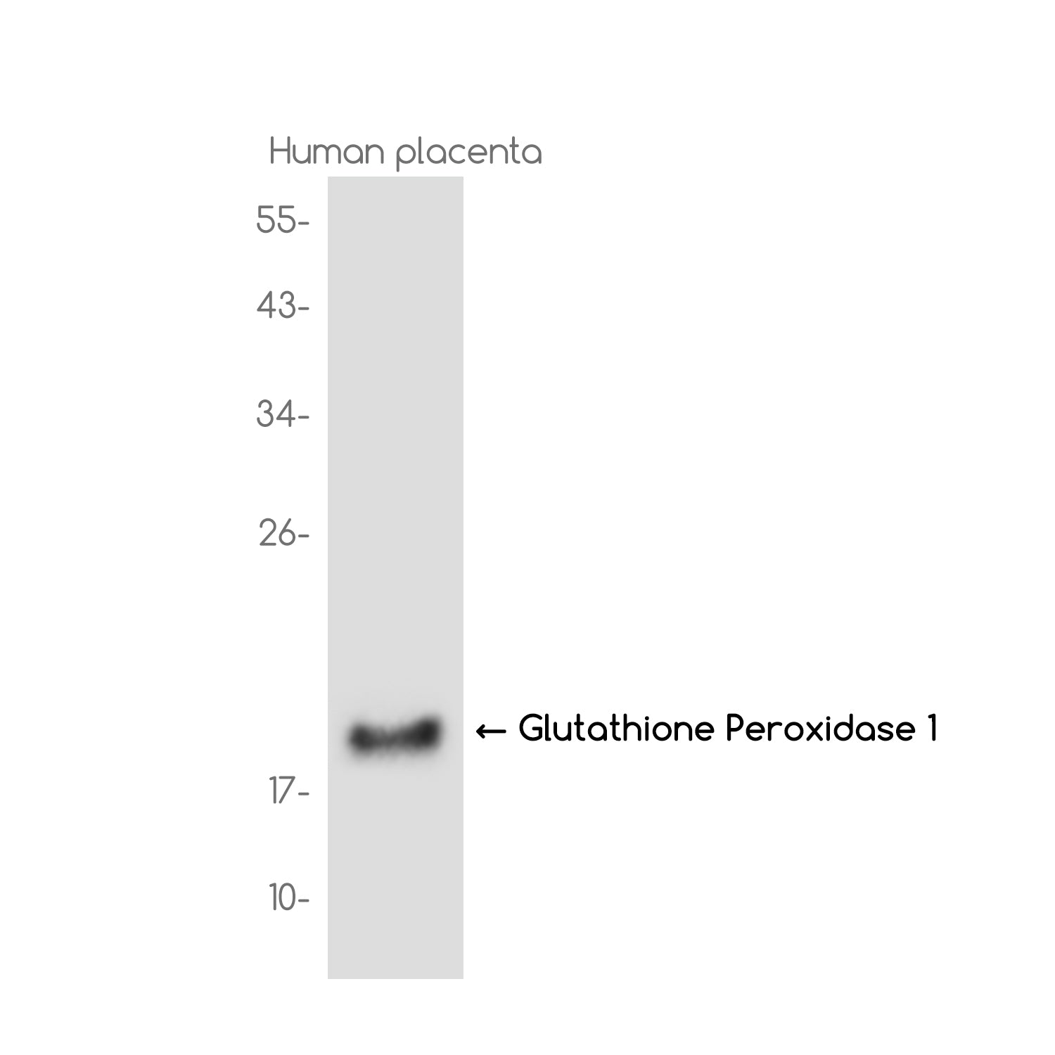 Anti-Glutathione Peroxidase 1 Rabbit Monoclonal Antibody