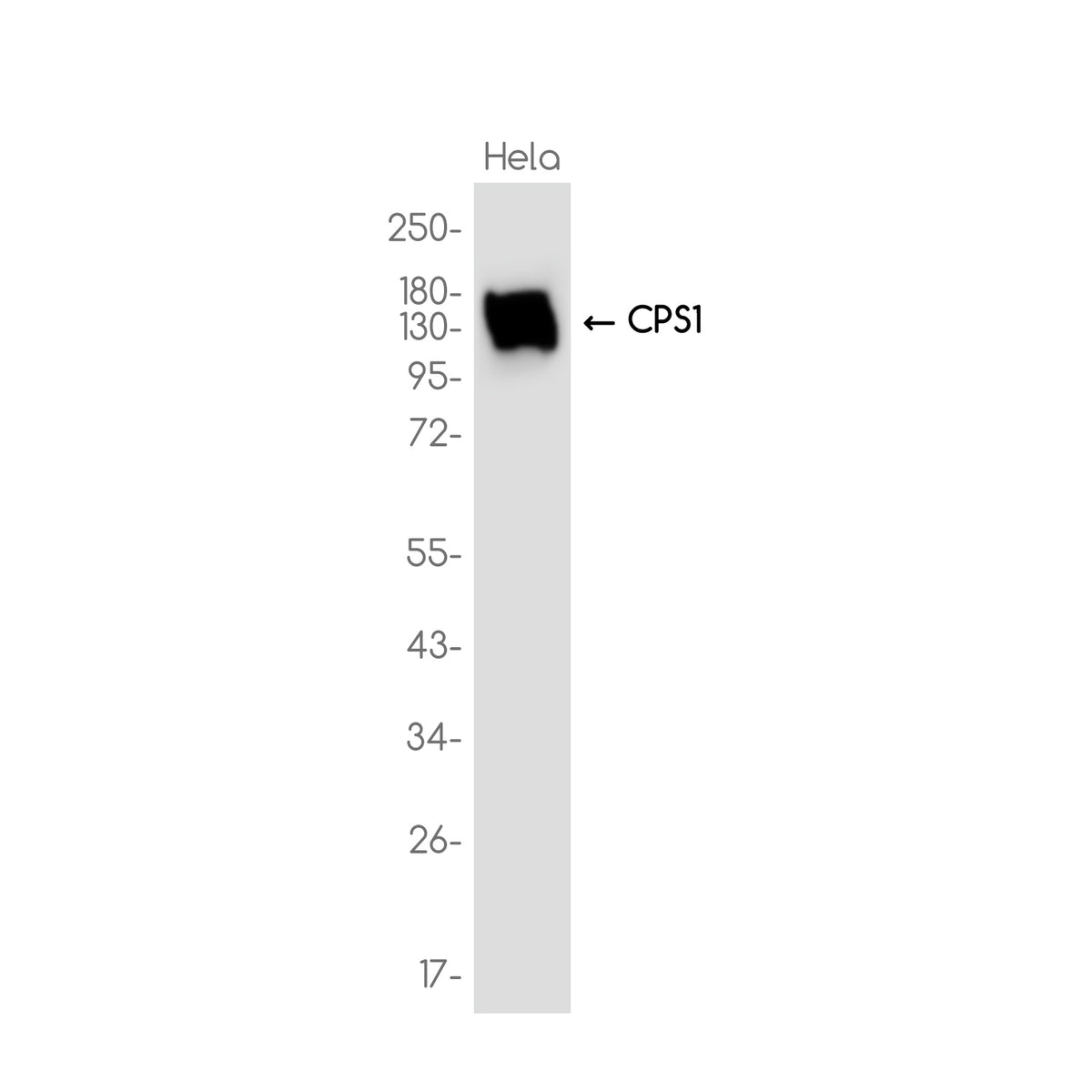 Anti-CPS1 Rabbit Monoclonal Antibody