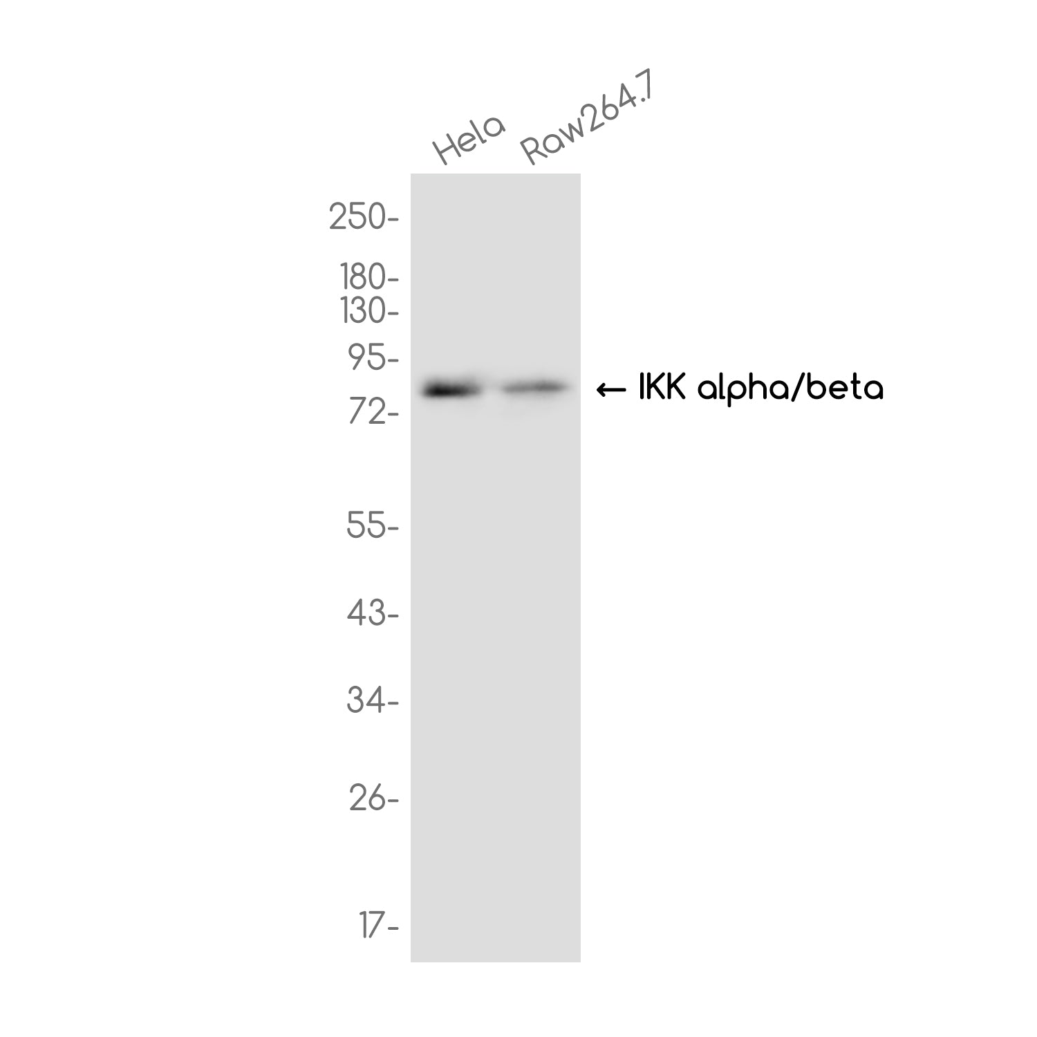 Anti-IKK alpha/beta Rabbit Monoclonal Antibody