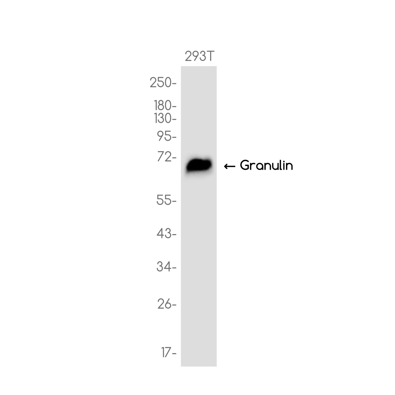 Anti-Granulin Rabbit Monoclonal Antibody