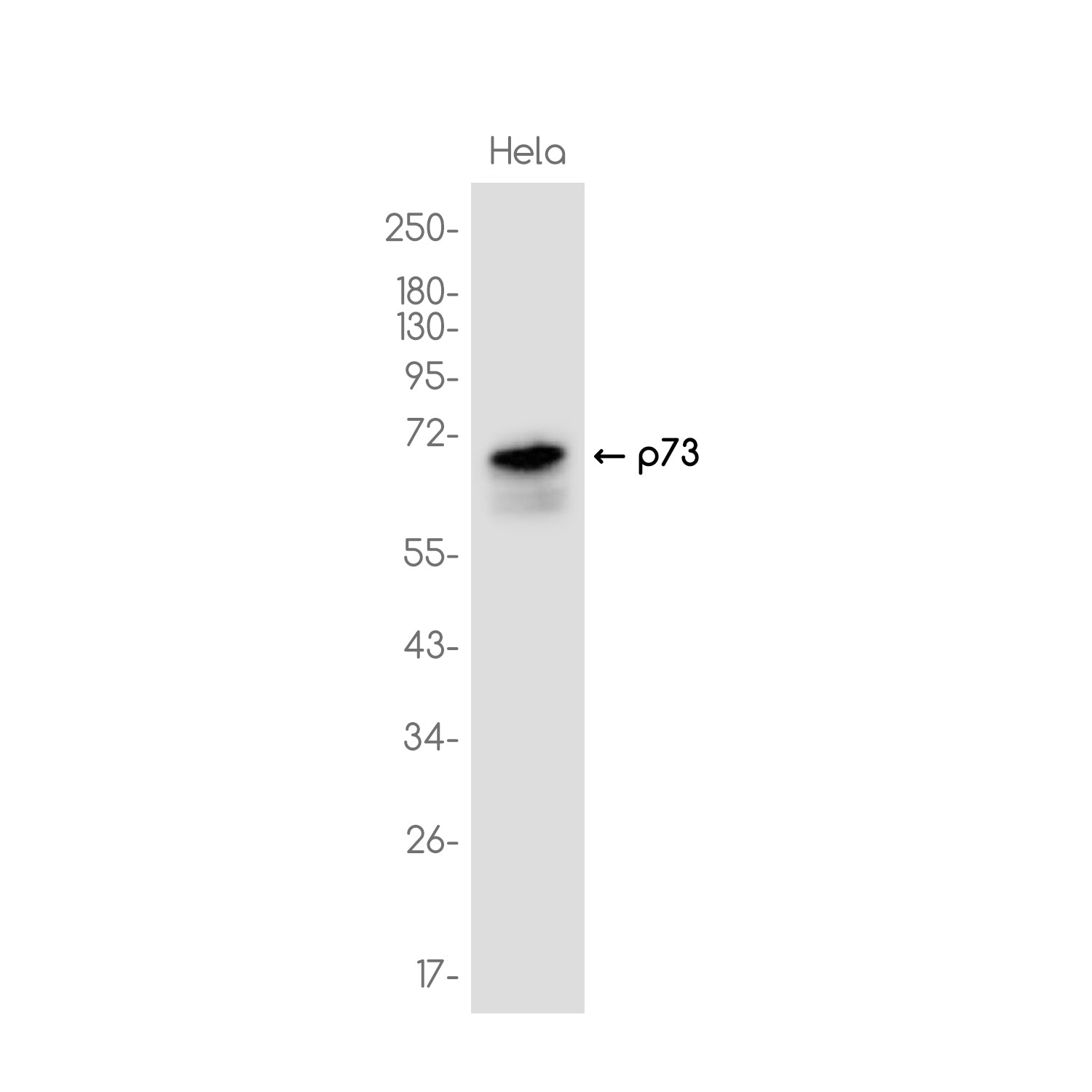 Anti-p73 Rabbit Monoclonal Antibody