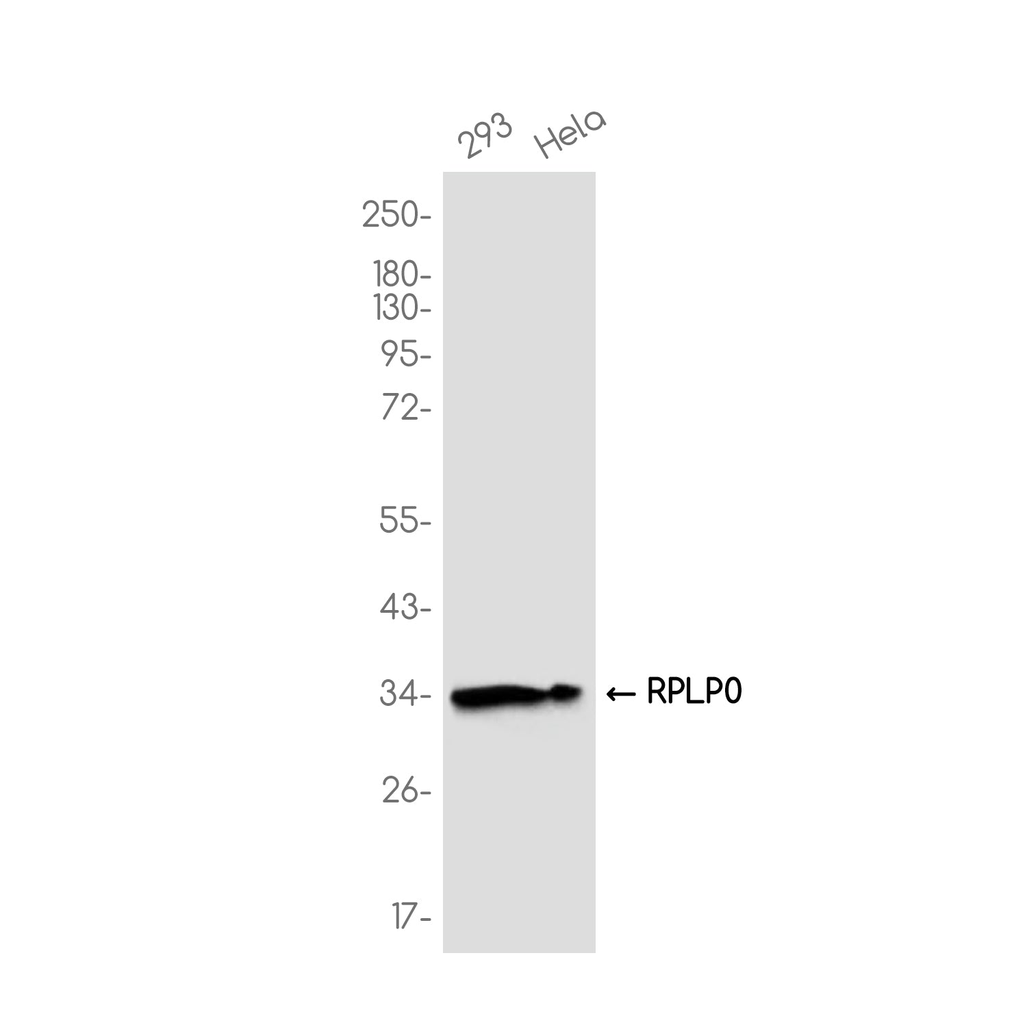 Anti-RPLP0 Rabbit Monoclonal Antibody
