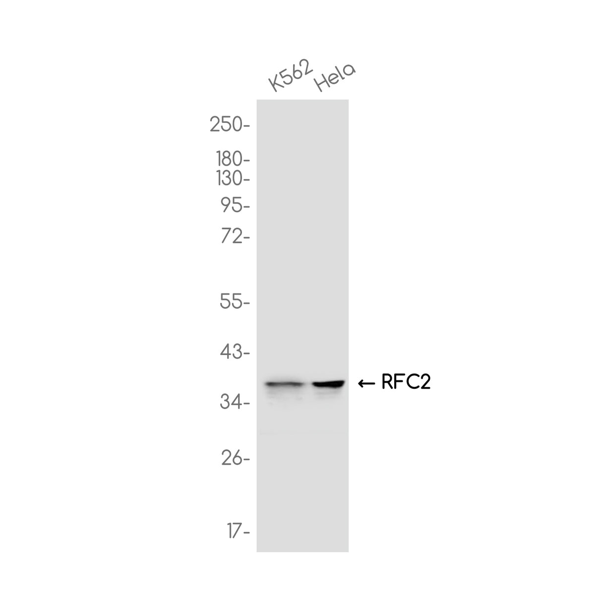 Anti-RFC2 Rabbit Monoclonal Antibody