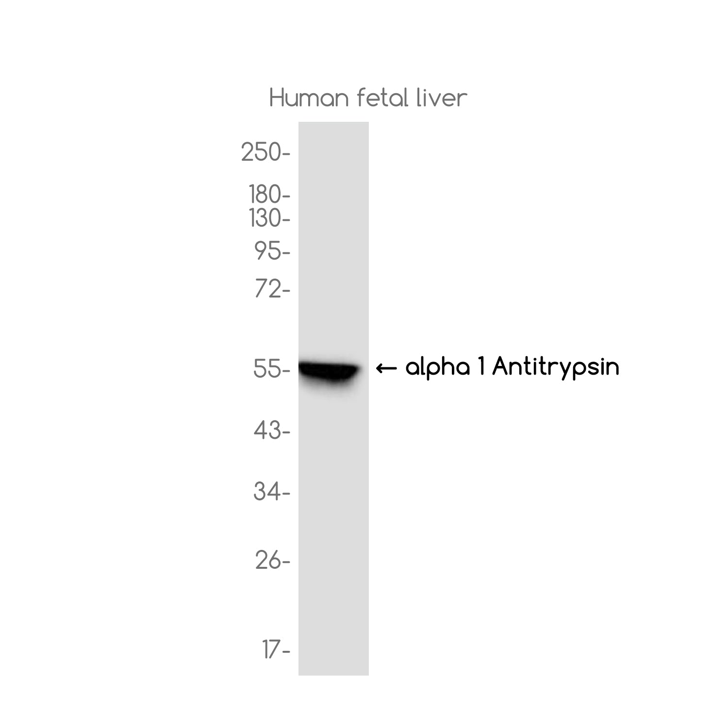 Anti-alpha 1-Antitrypsin Rabbit Monoclonal Antibody