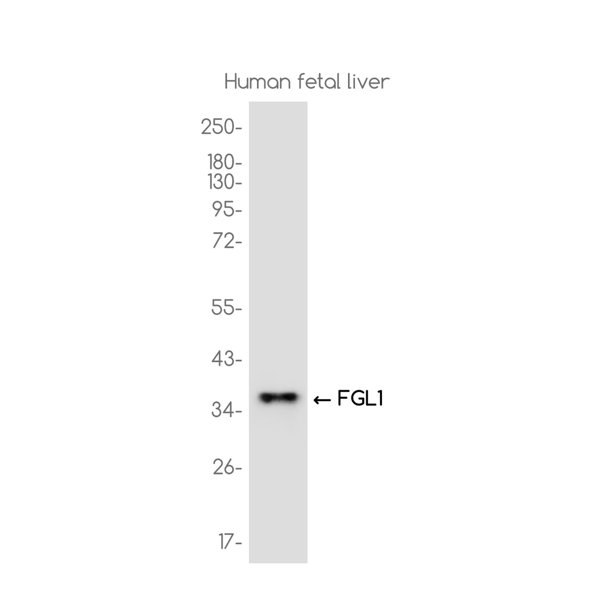 Anti-FGL1 Rabbit Monoclonal Antibody
