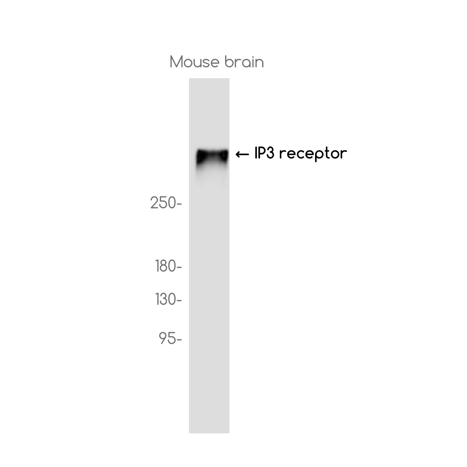 Anti-IP3 Receptor Rabbit Monoclonal Antibody