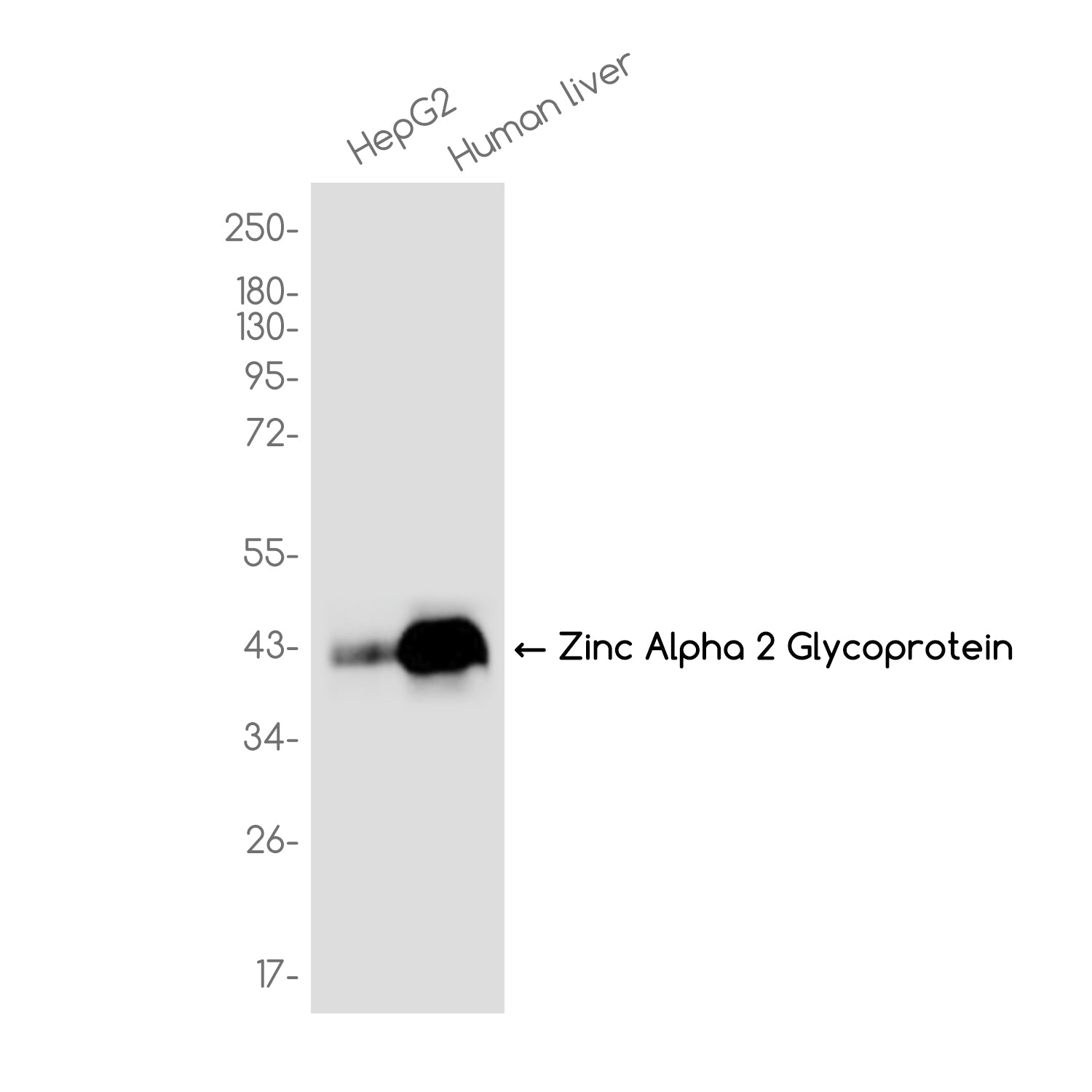 Anti-Zinc Alpha 2 Glycoprotein Rabbit Monoclonal Antibody