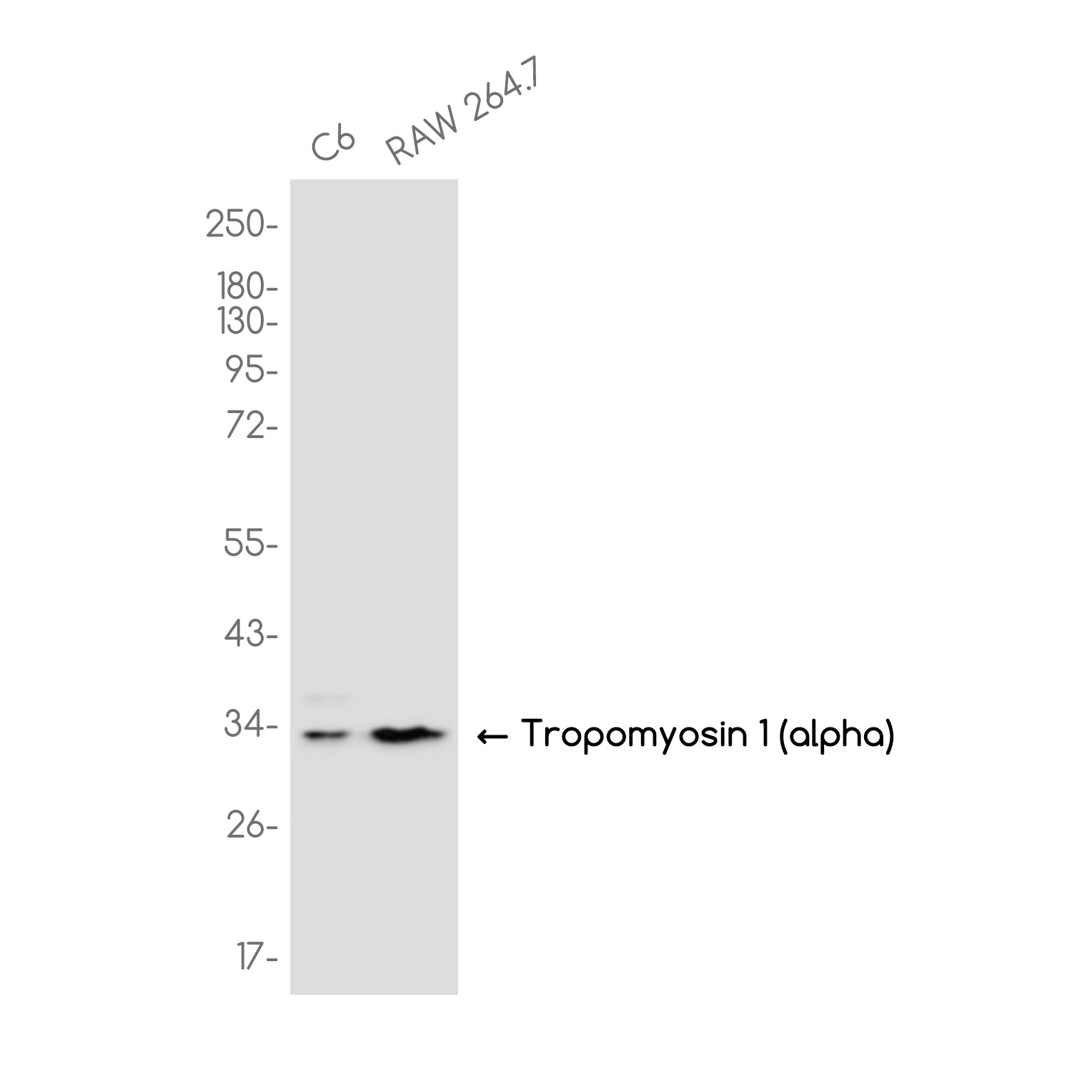 Anti-Tropomyosin alpha 1 Chain Rabbit Monoclonal Antibody