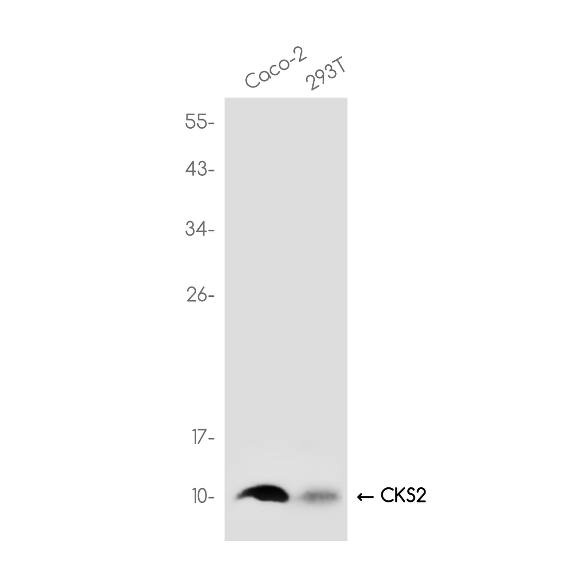 Anti-CKS2 Rabbit Monoclonal Antibody