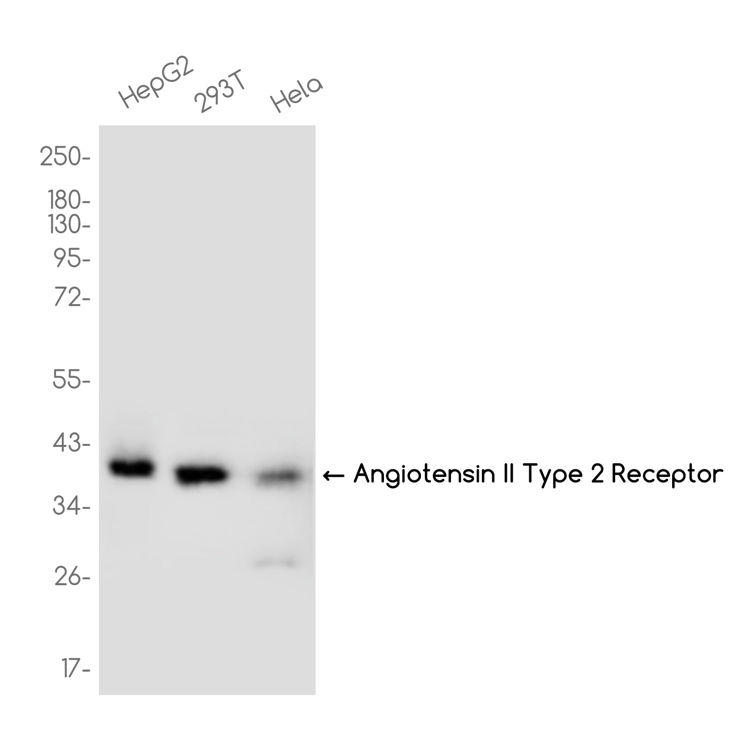 Anti-AGTR2 Receptor Rabbit Monoclonal Antibody