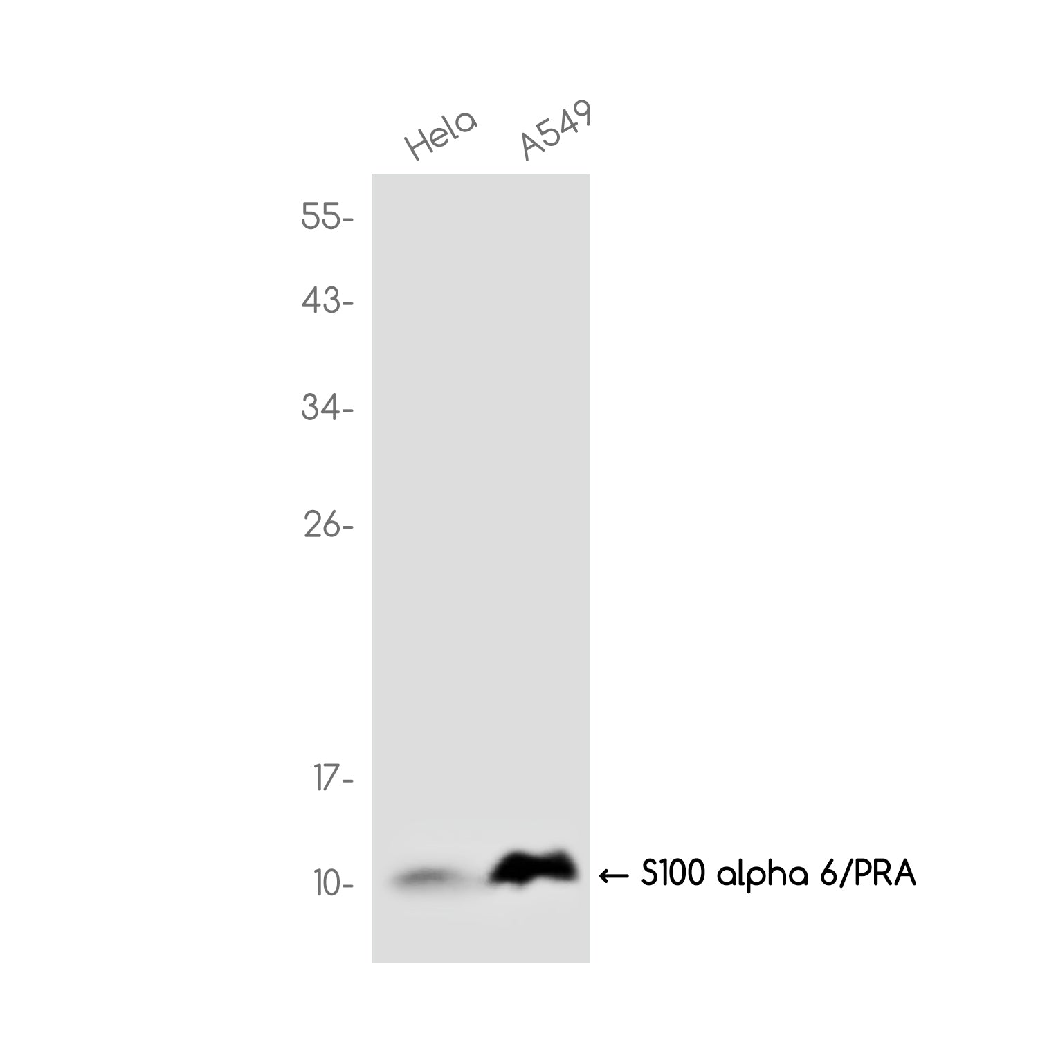 Anti-S100 alpha 6/PRA Rabbit Monoclonal Antibody