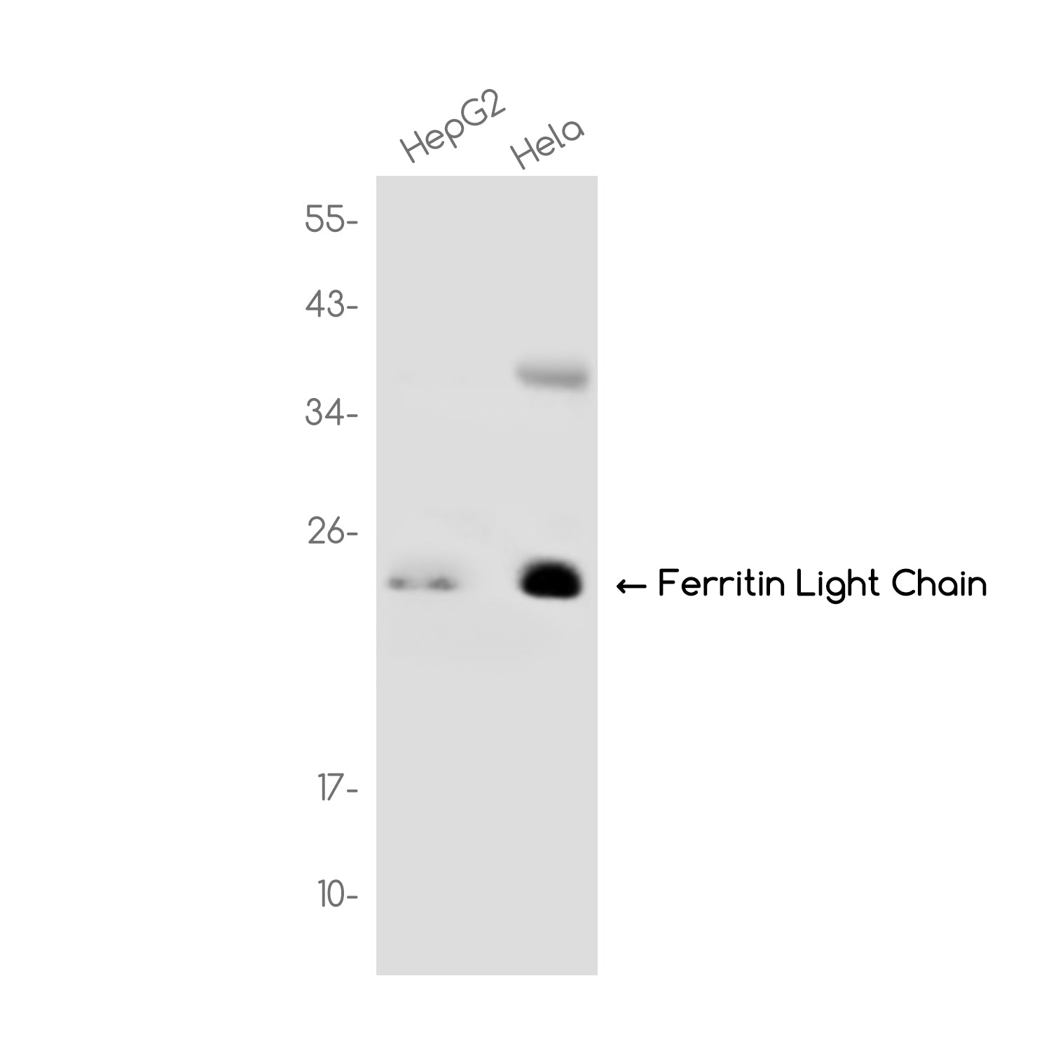 Anti-Ferritin Light Chain Rabbit Monoclonal Antibody