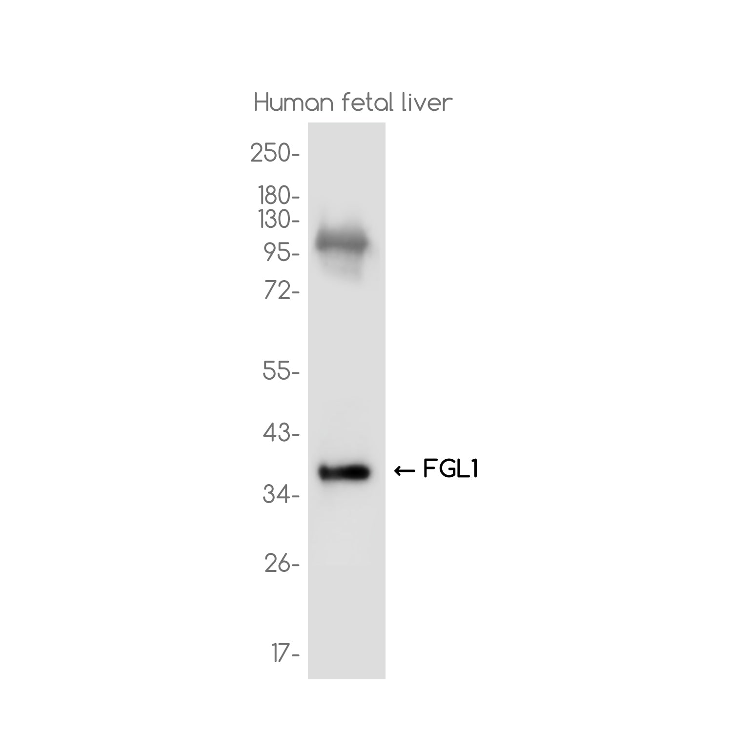 Anti-FGL1 Rabbit Monoclonal Antibody