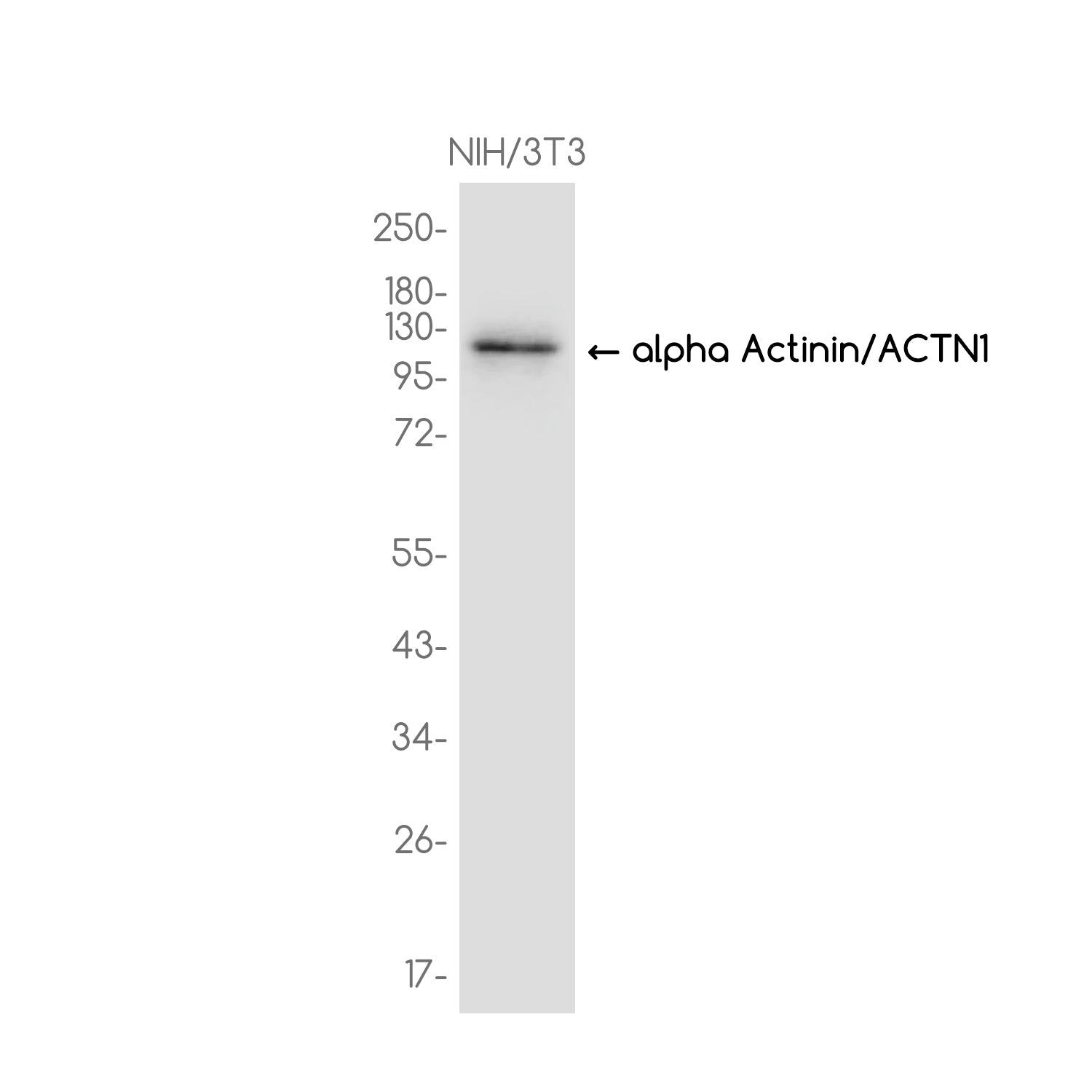 Anti-alpha Actinin/ACTN1 Rabbit Monoclonal Antibody
