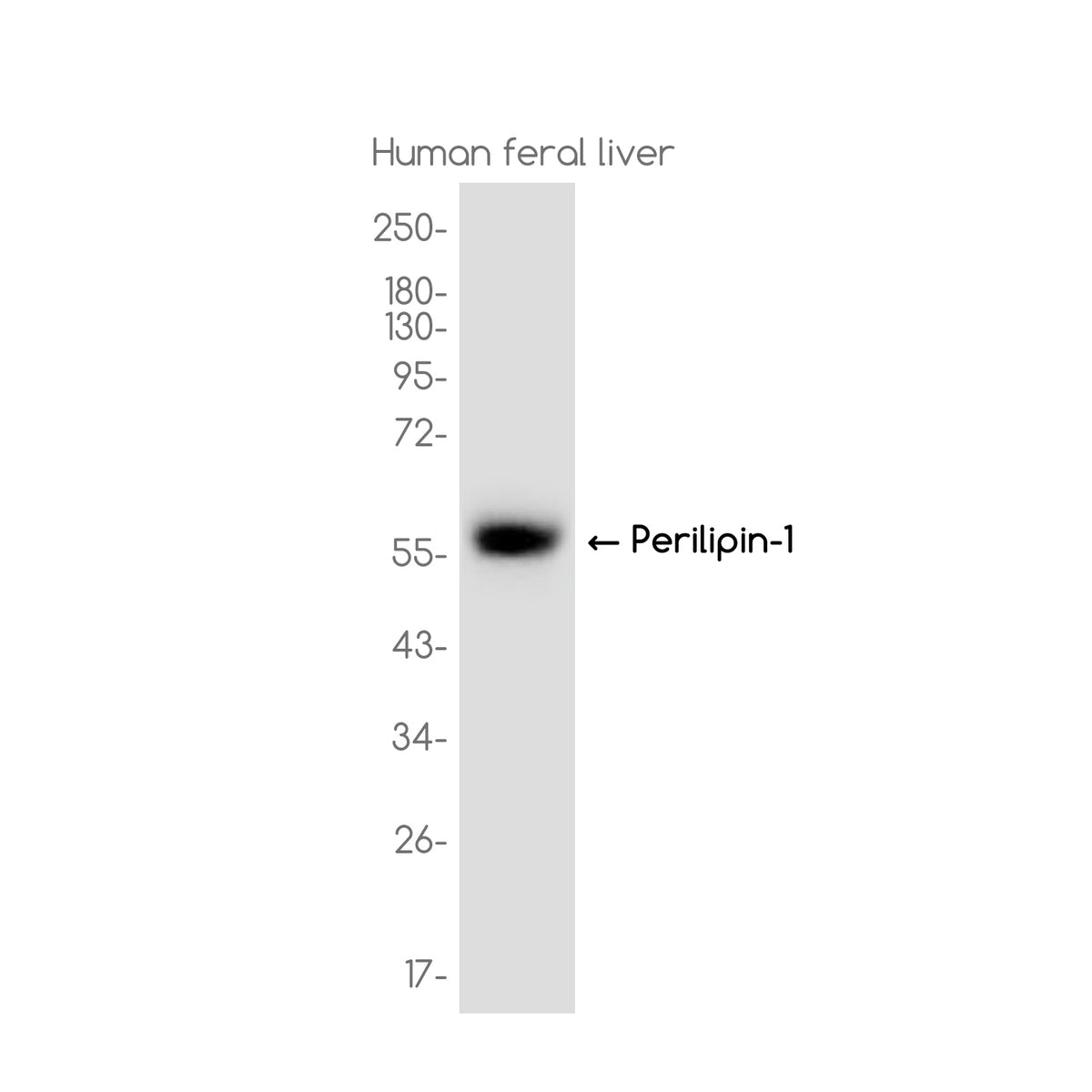 Anti-Perilipin 1 Rabbit Monoclonal Antibody