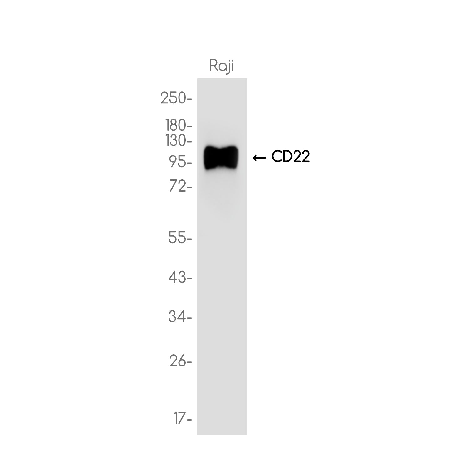 Anti-CD22 Rabbit Monoclonal Antibody