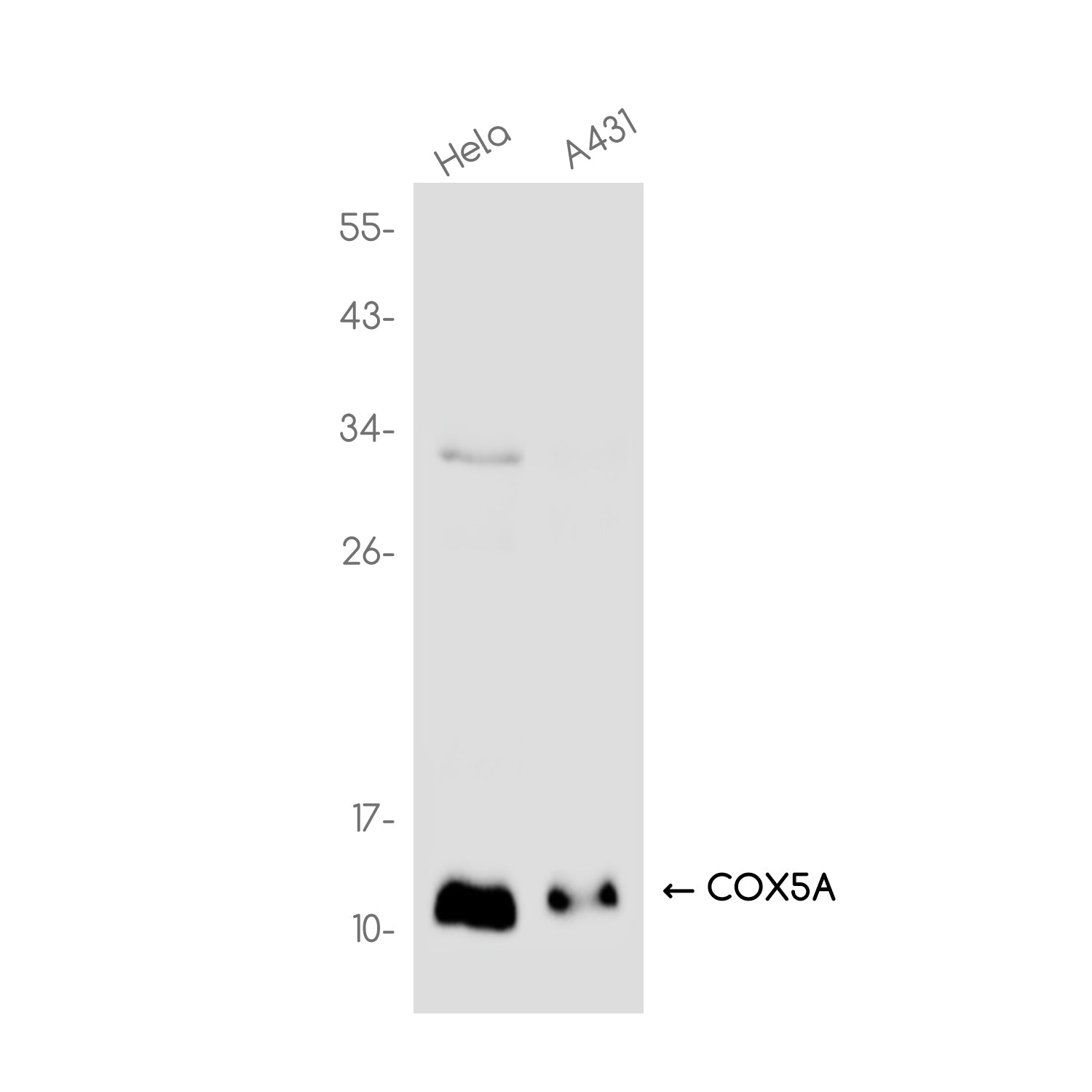 Anti-COX5A Rabbit Monoclonal Antibody