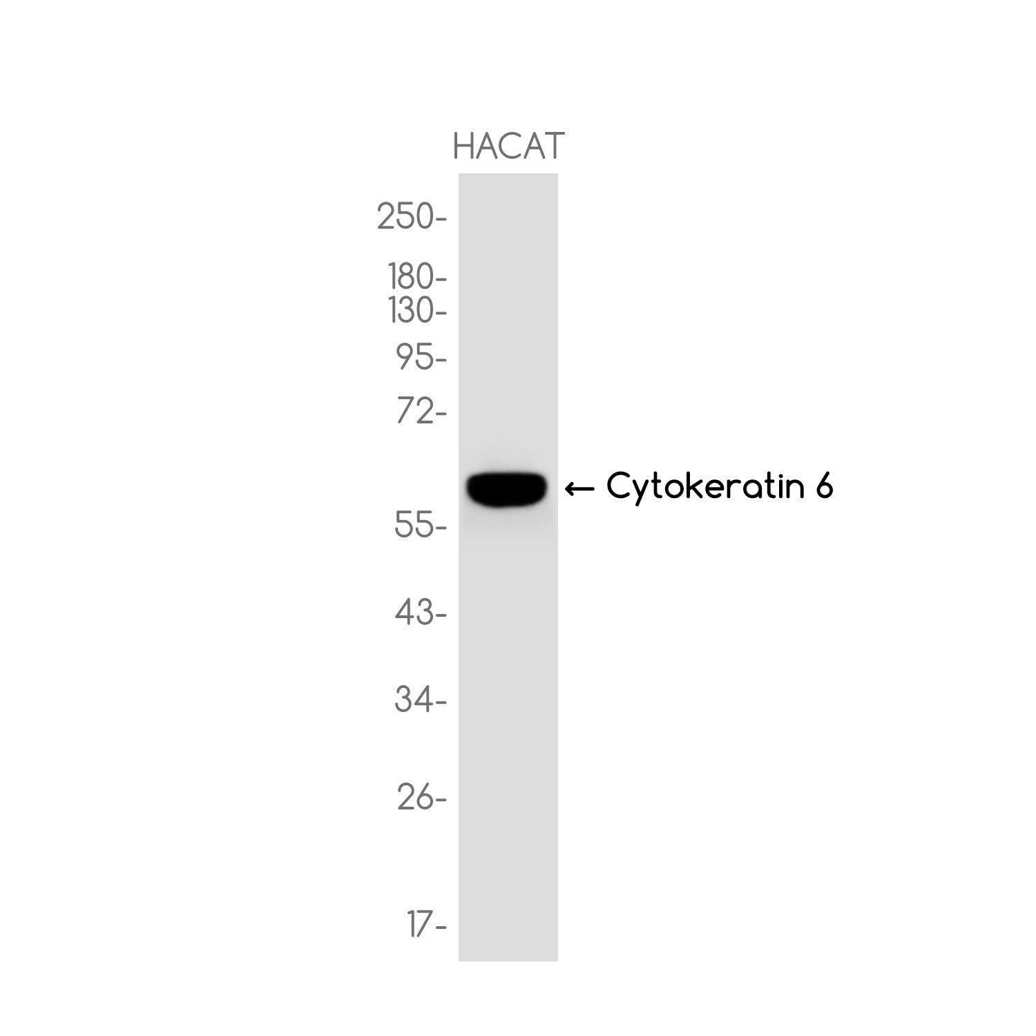 Anti-Cytokeratin 6 Rabbit Monoclonal Antibody
