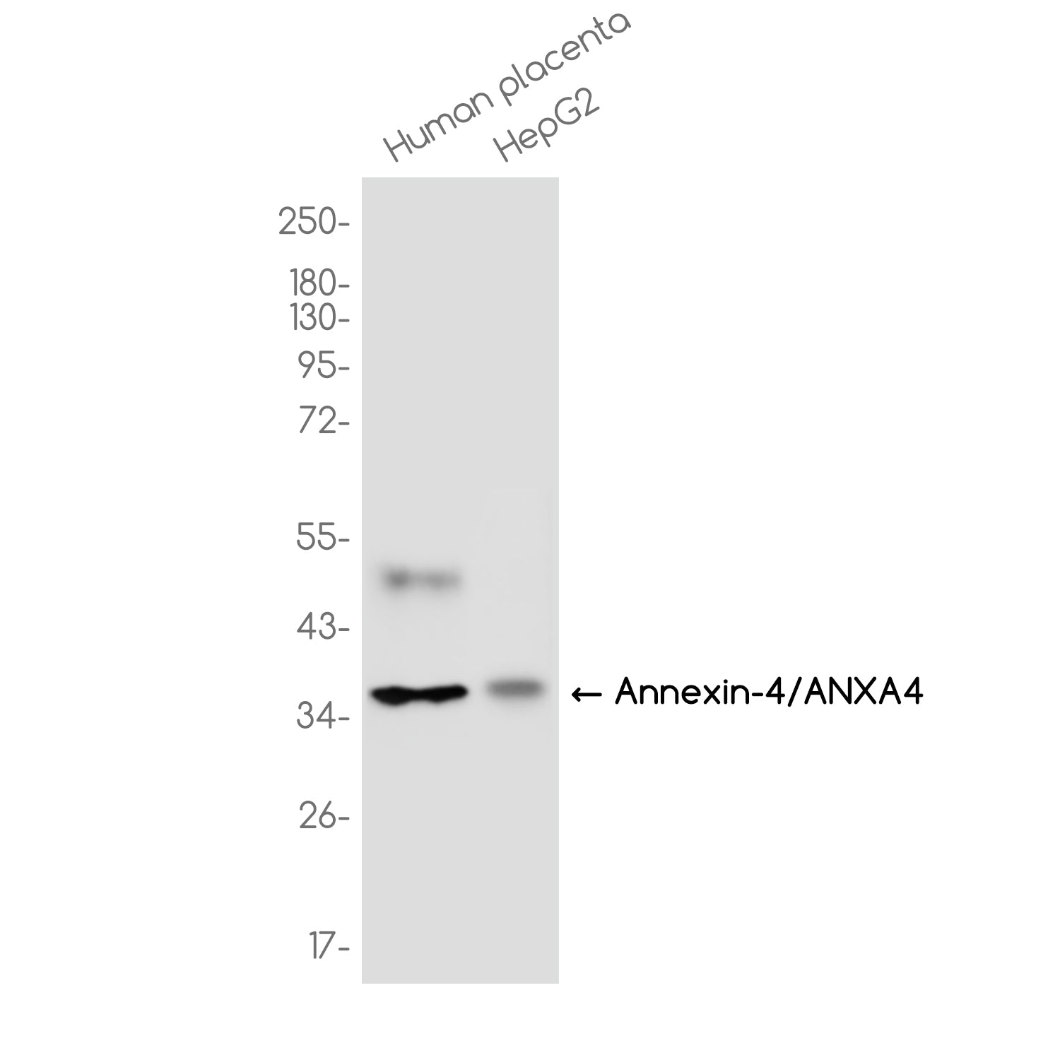Anti-Annexin 4/ANXA4 Rabbit Monoclonal Antibody