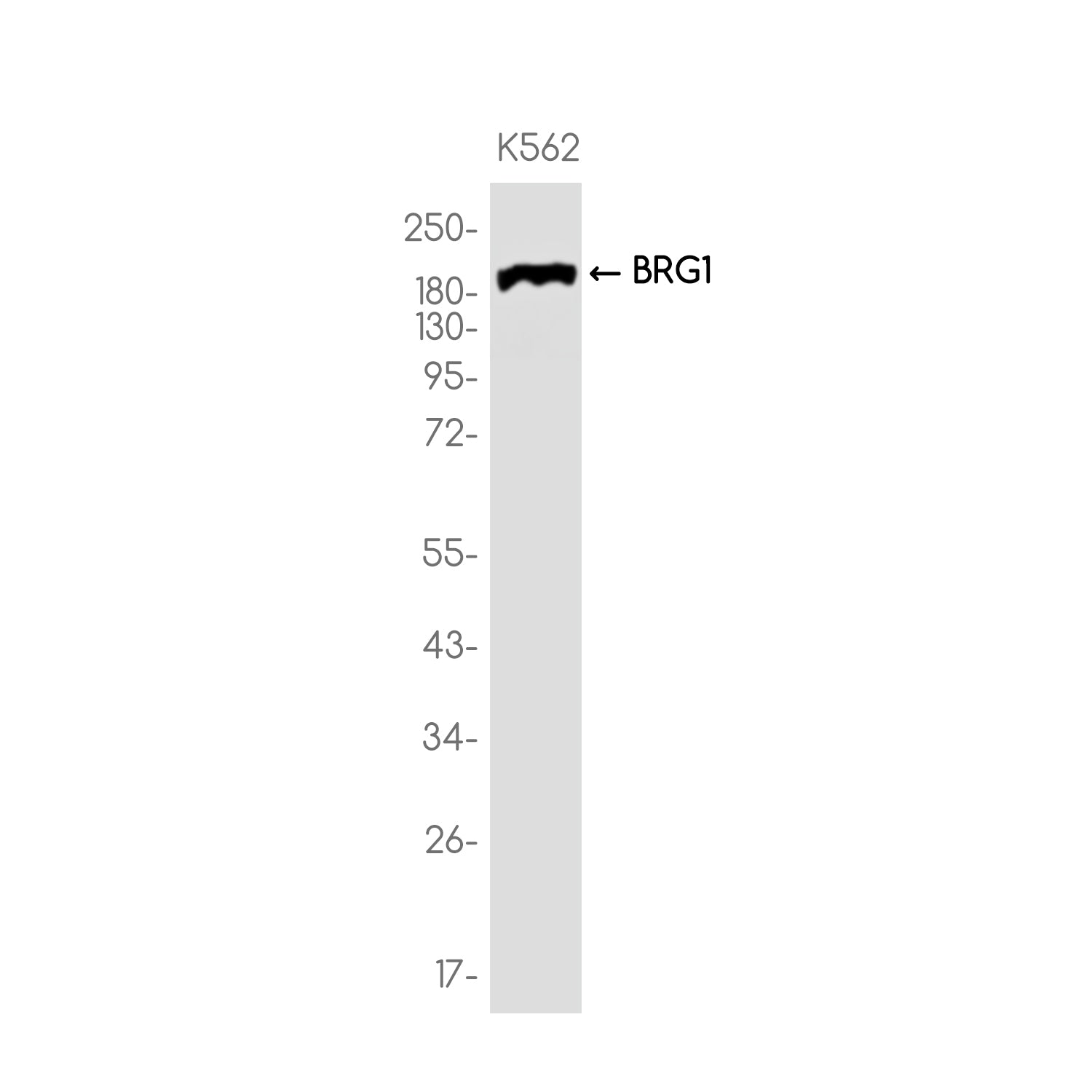 Anti-BRG1 Rabbit Monoclonal Antibody