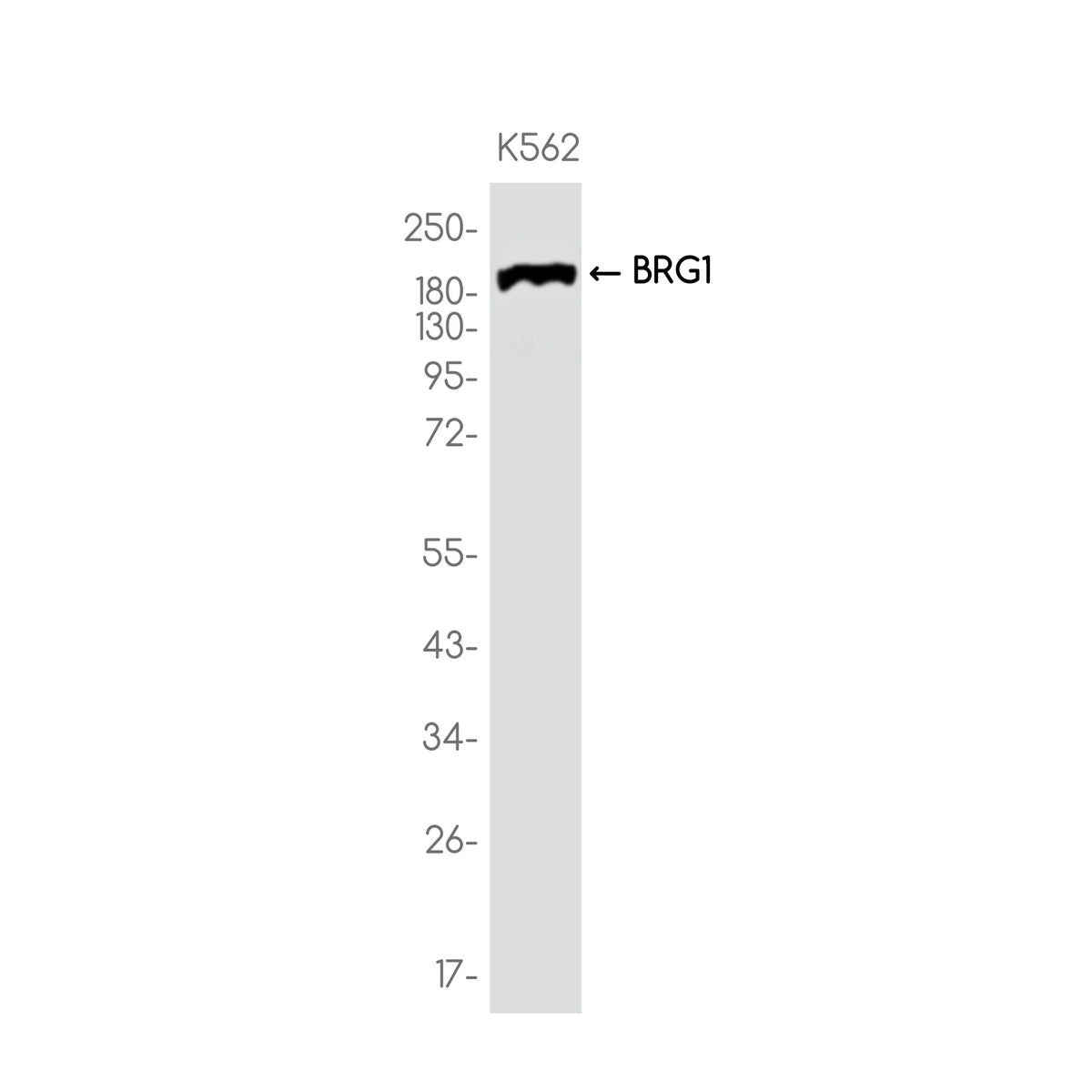Anti-BRG1 Rabbit Monoclonal Antibody