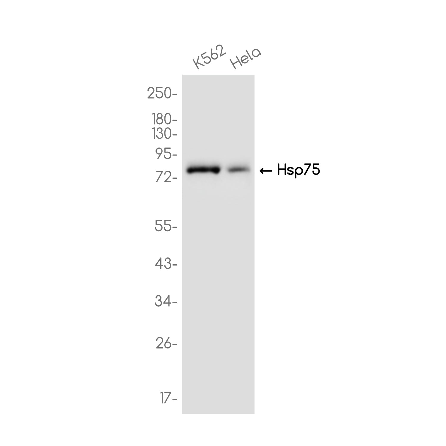 Anti-Hsp75 Rabbit Monoclonal Antibody
