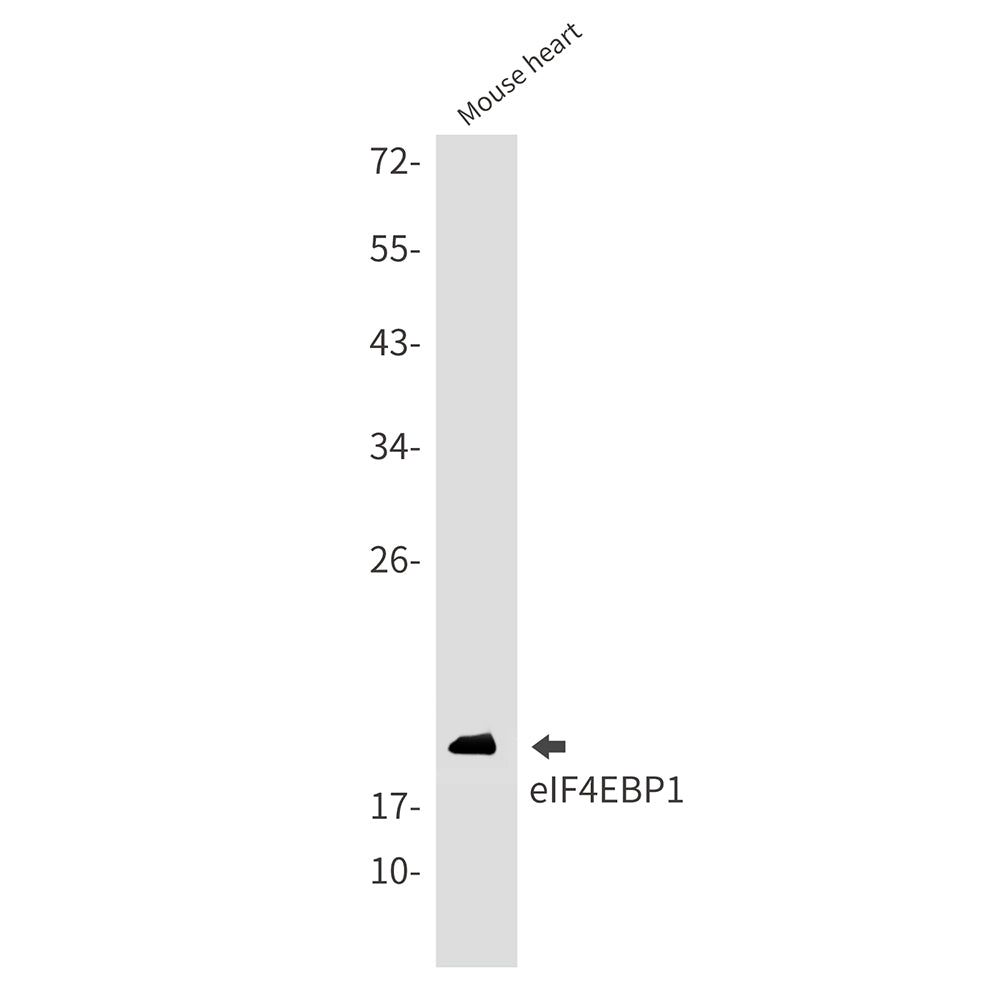 Anti-4E BP1 Rabbit Monoclonal Antibody [KO]