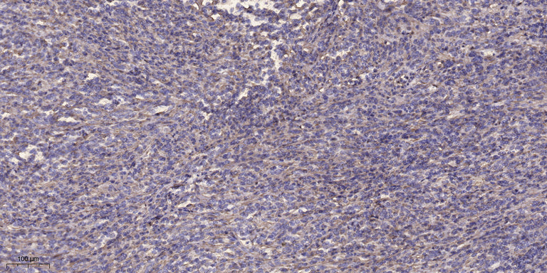 Anti-beta-Tubulin Antibody (5G3), Cy3 Conjugated