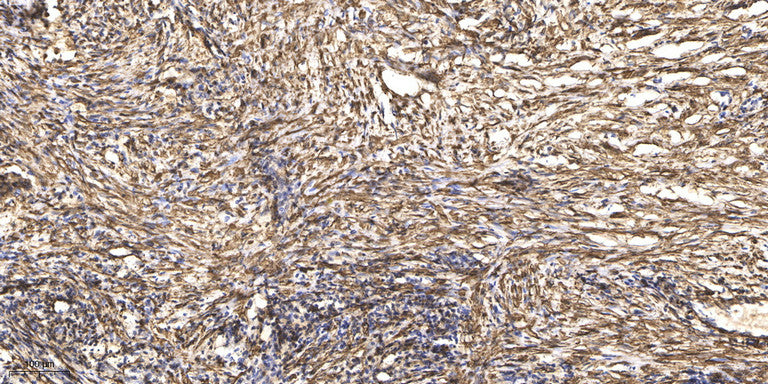Anti-beta-Tubulin Antibody (5G3), Cy5 Conjugated