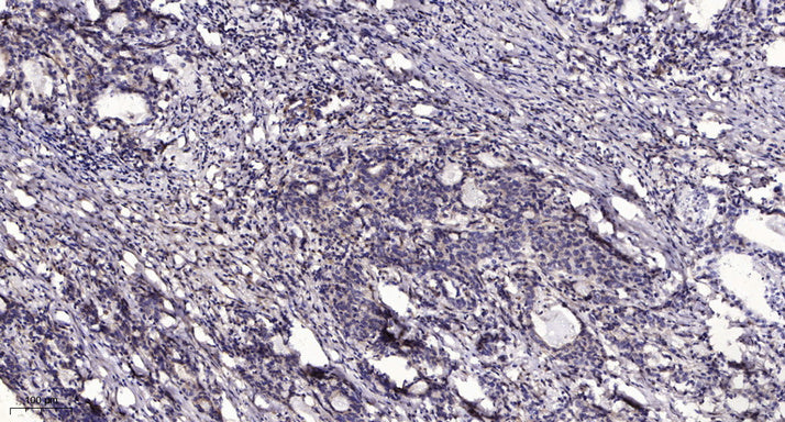 Anti-beta-Tubulin Antibody (5G3), HRP Conjugated