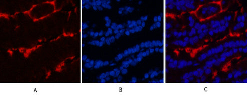 Anti-beta-Tubulin Antibody (5G3)