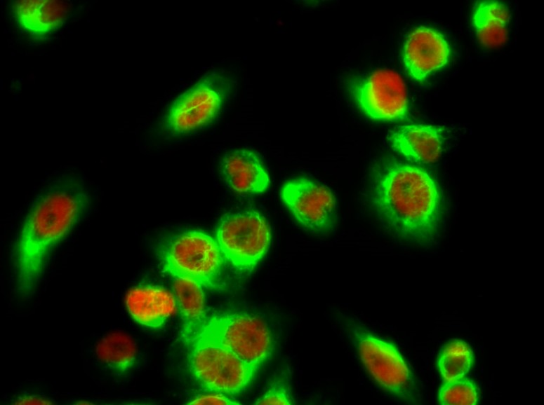 Anti-beta-Tubulin Antibody (5G3)