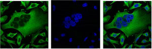Anti-beta-Tubulin Antibody (5G3)