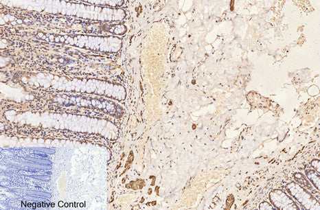 Anti-beta-Tubulin Antibody (5G3)