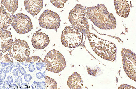 Anti-beta-Tubulin Antibody (5G3)