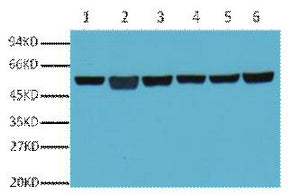 Anti-beta-Tubulin Antibody (5G3)