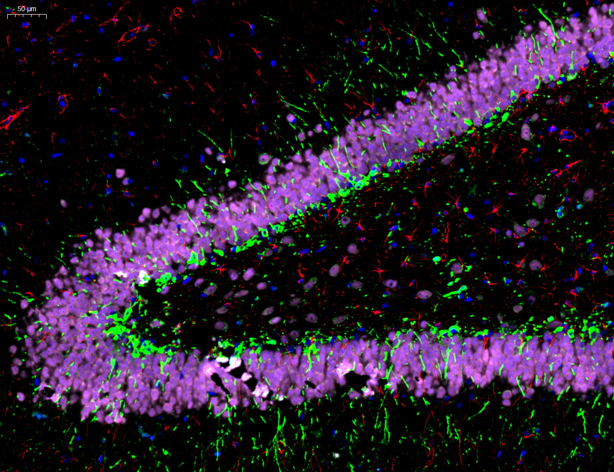 Goat Anti-Mouse/Rabbit Multiplex IHC Detection Kit (Triple)