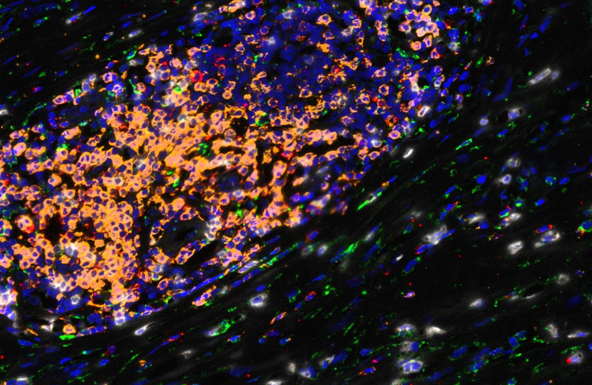 Goat Anti-Mouse/Rabbit Multiplex IHC Detection Kit (Quintuple)