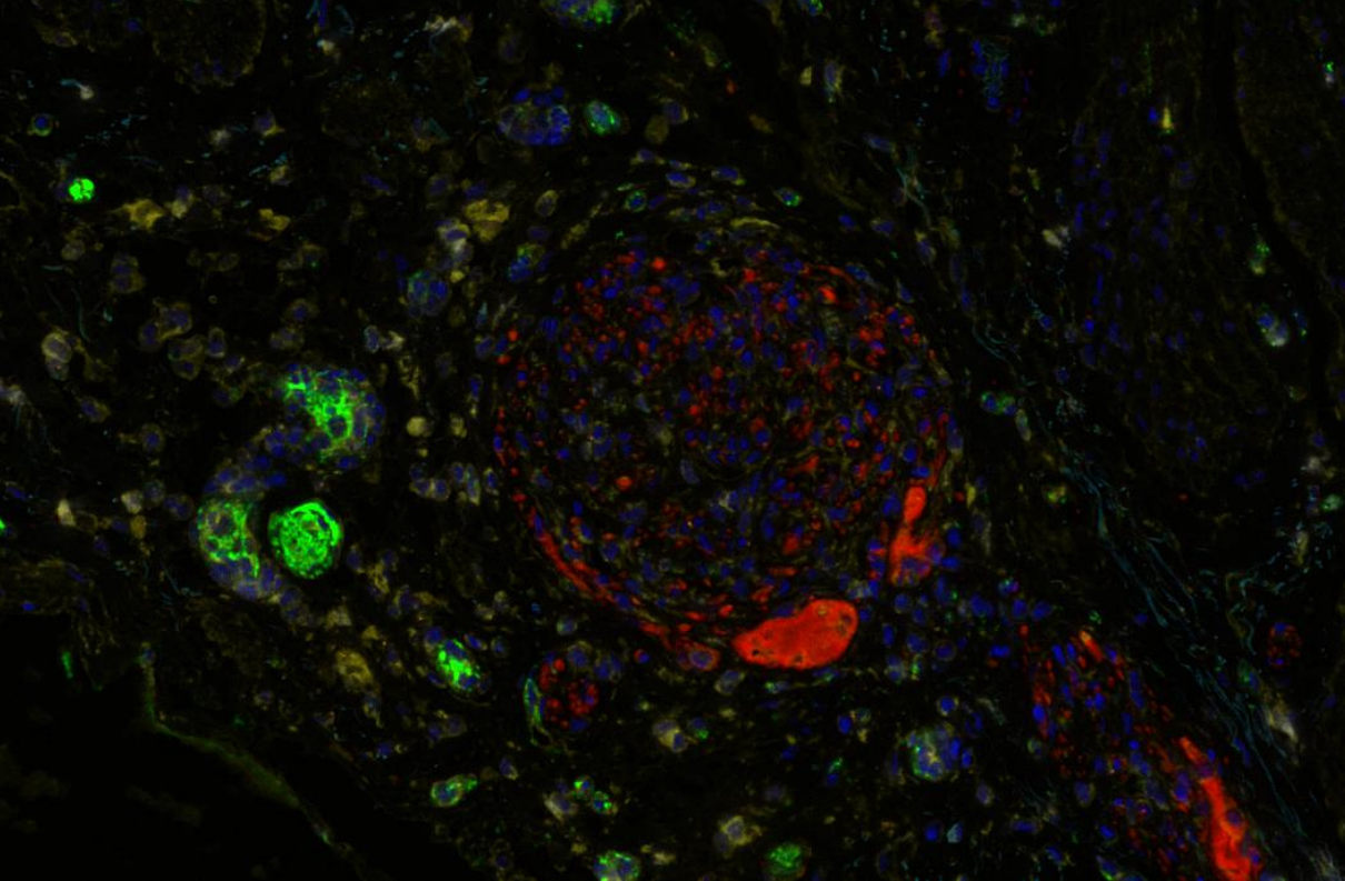 Goat Anti-Mouse/Rabbit Multiplex IHC Detection Kit (Sextuple)