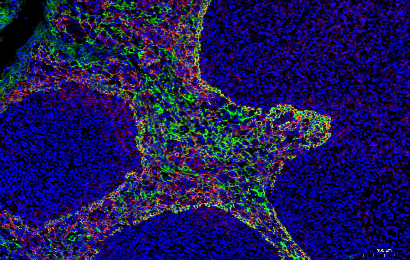 Goat Anti-Mouse/Rabbit Multiplex IHC Detection Kit (For Frozen section/Cell slides, Double)