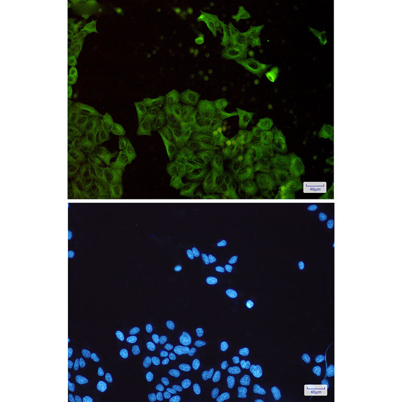 beta Tubulin Rabbit Monoclonal Antibody