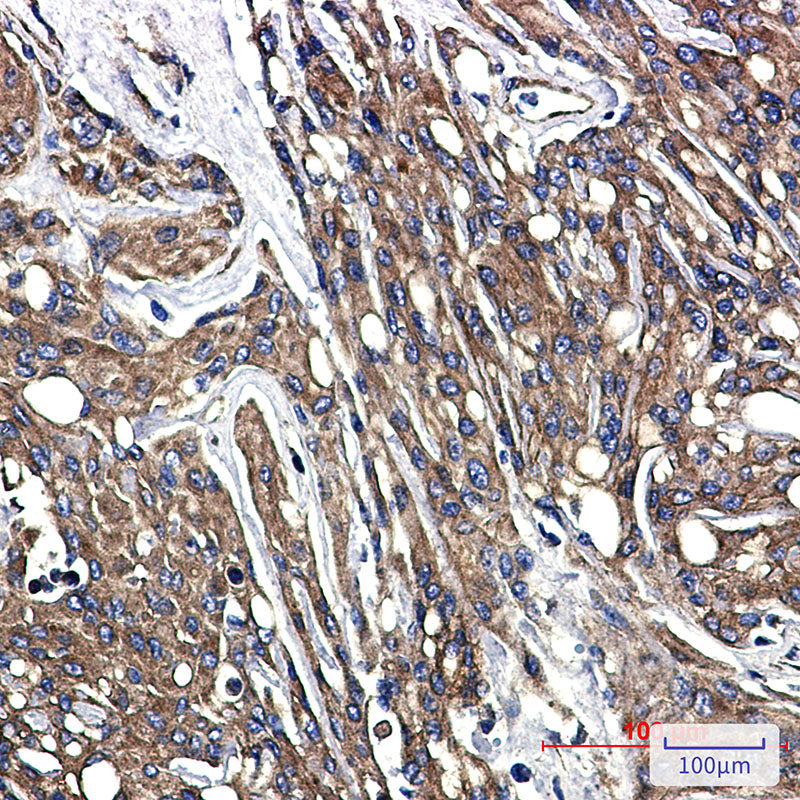 beta Tubulin Rabbit Monoclonal Antibody
