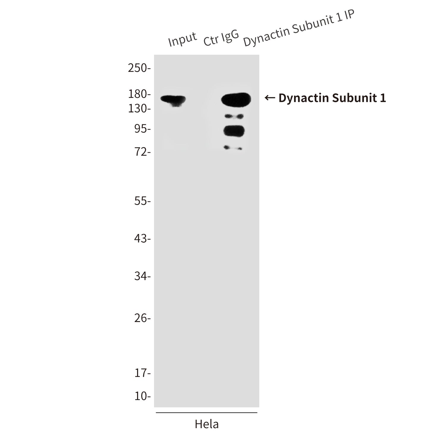 Dynactin Subunit 1 (3D5) Mouse Monoclonal Antibody