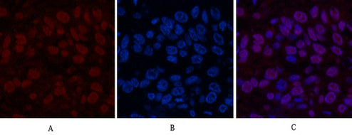 Transferrin (6C9) Mouse Monoclonal Antibody