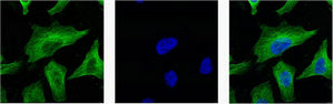 beta Tubulin (10B7) Mouse Monoclonal Antibody