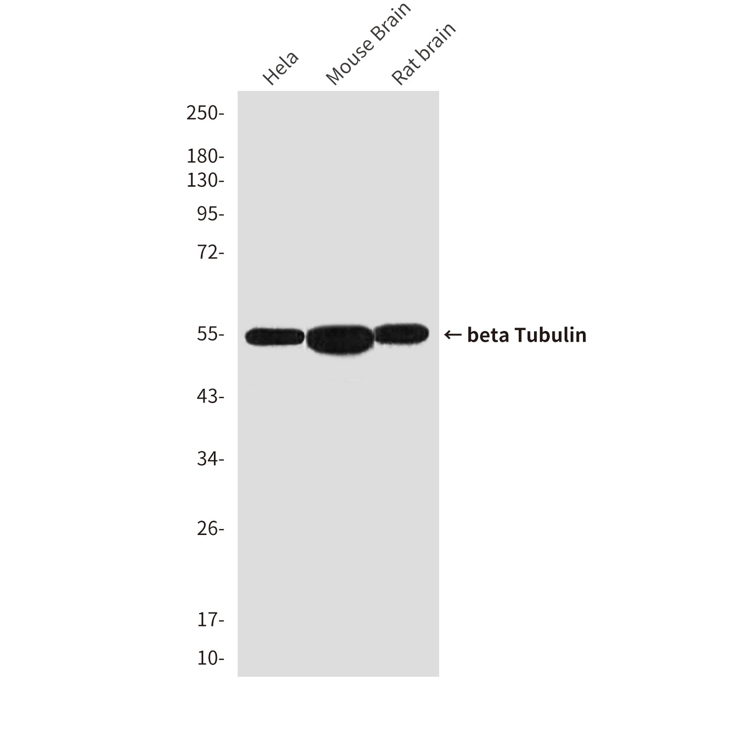 beta Tubulin (10B7) Mouse Monoclonal Antibody