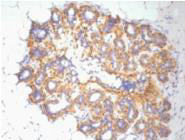 beta Actin (6F9) Mouse Monoclonal Antibody